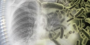 Infecciones pulmonares